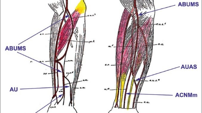 The scheme of two cases of a variant artery as drawn by Schwalbe in 1898. Legend: ABUMS – arteria brachioulnomediana superficialis, ACNMm – arteria comitans nervi mediani manus, AUAS – arteria ulnaris accessoria superficialis, AU – arteria ulnaris.