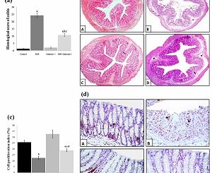 The role of galectin-1 in prevention and treatment of ulcerative colitis