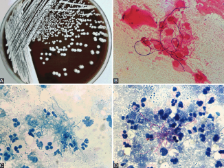 Nocardia species identification, clinical characteristics, and antimicrobial susceptibility