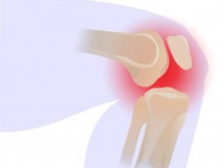 The use of cellular matrix in symptomatic knee osteoarthritis