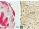 The role of global DNA methylation in rat limb bud development in vitro