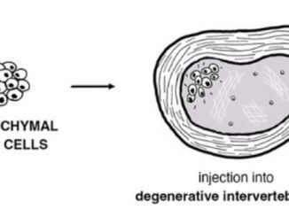 Regenerative Medicine: Stem Cell Therapy’s Potential in Treating Degenerative Disc Disease