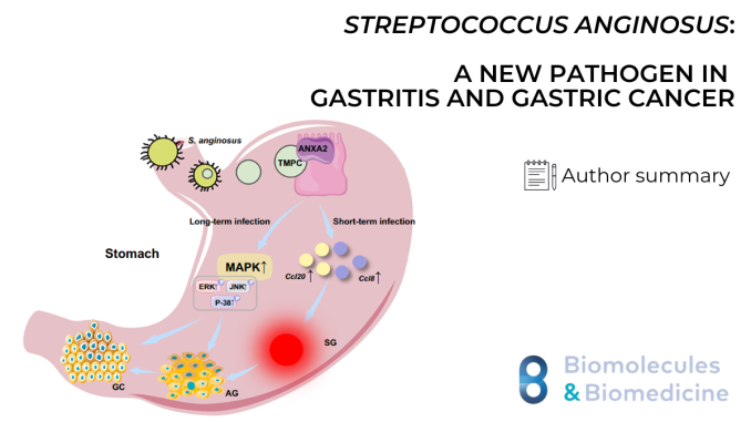 Streptococcus anginosus: A New Pathogen in Gastritis and Gastric Cancer